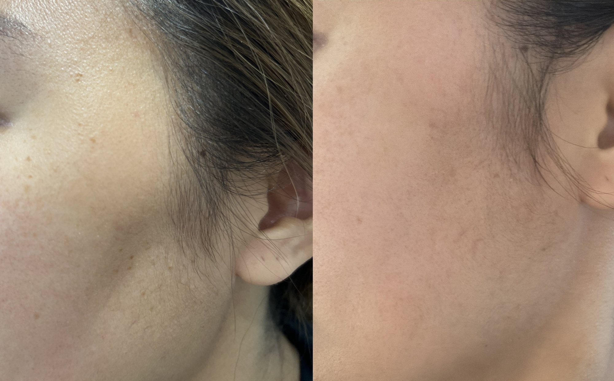 before-after-2